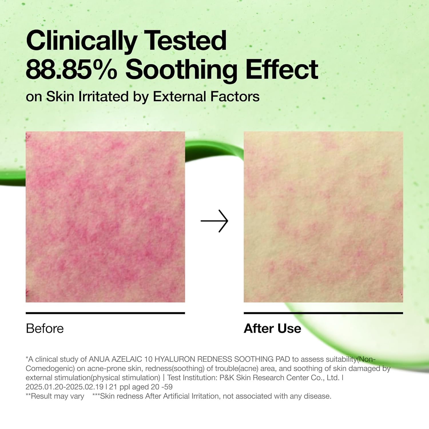 Anua Azelaic 10 Hyaluron Redness Soothing Pad - 90 Pieces view 4