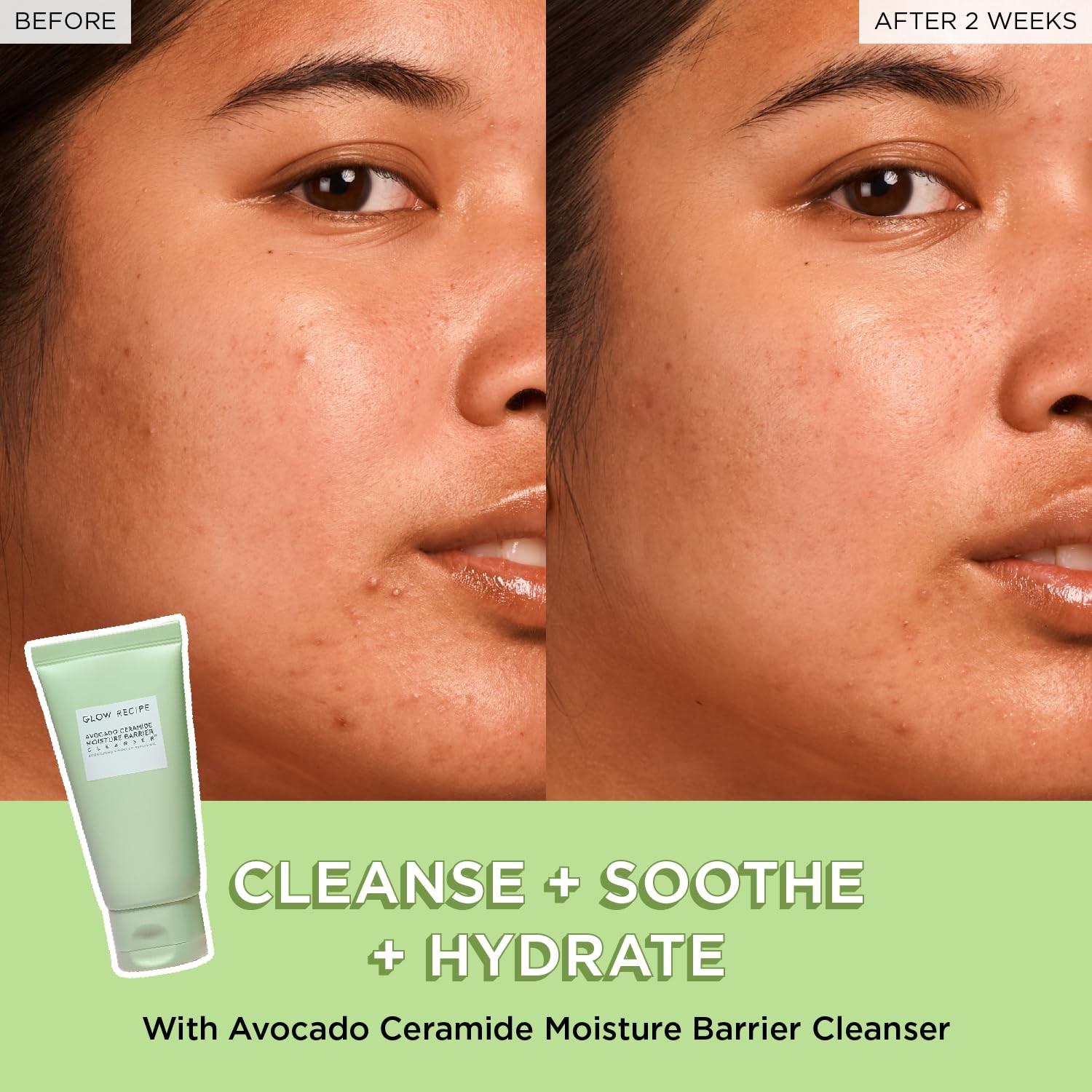 GLOW RECIPE FRUIT BABIES GLOW&SOOTHE KIT 6 IN 1 alternate view