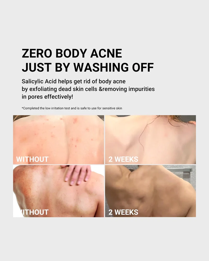 Body Wash Anti‑Acne from Medicube - AHA BHA PHA Niacinamide 400g view 3