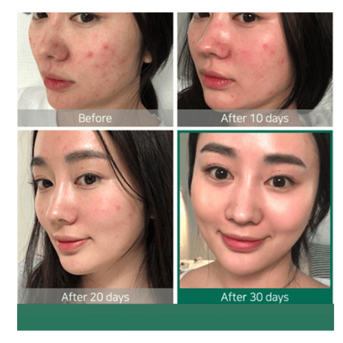 The Ordinary AHA 30% + BHA 2% Peeling Solution - 30ml view 5