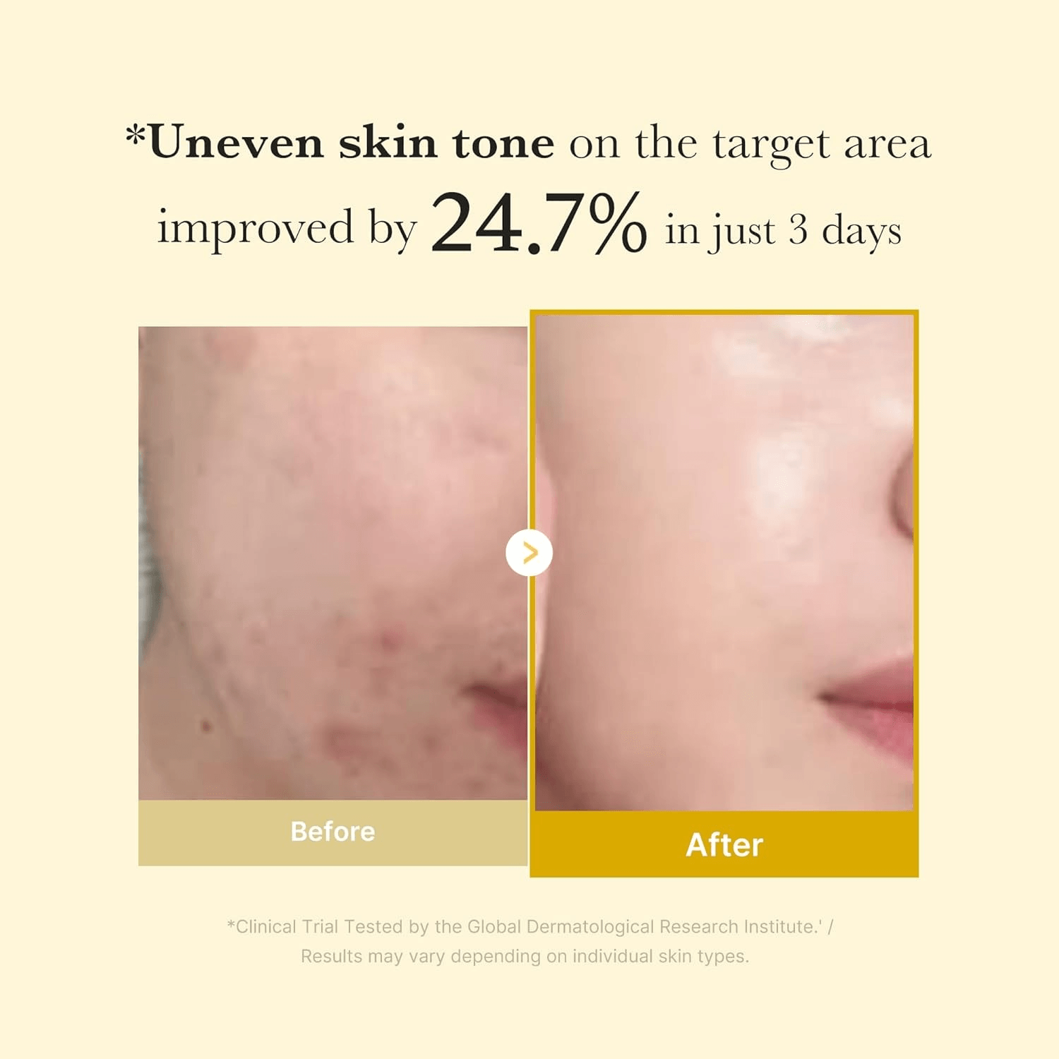 Medicube Night Mask with Kojic Acid & Turmeric for Brightening and Even Skin Tone – 75ml view 4