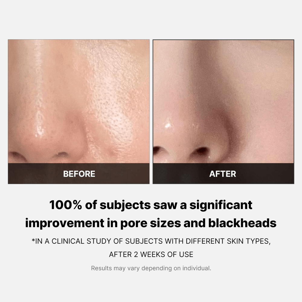 Medicube Zero Pore Pad - 70 pads view 4