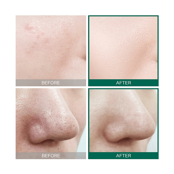 Some By Mi AHA. BHA. PHA 30 Days Miracle Toner - 150ml view 5