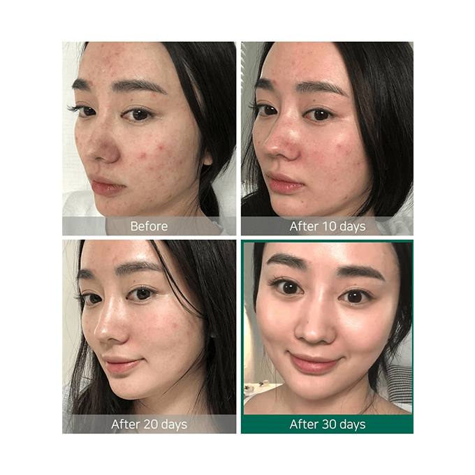 Some By Mi AHA. BHA. PHA 30 Days Miracle Toner - 150ml view 6