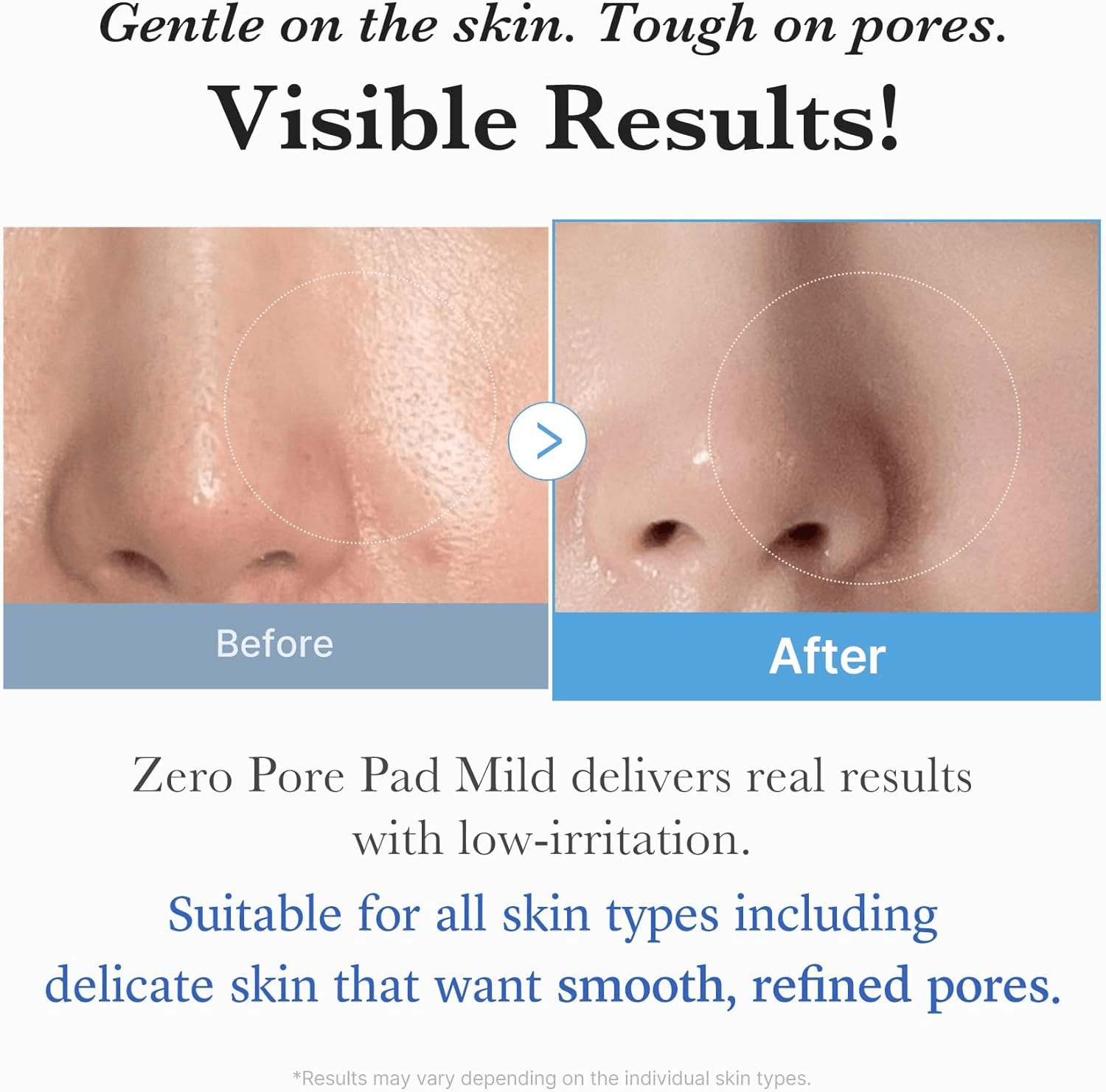 Medicube Zero Pore Pads Mild 70 pads view 4