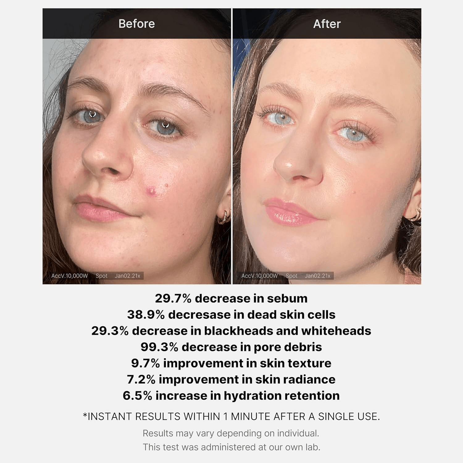 Medicube Red Acne Succinc Acid Peel - 40G view 4