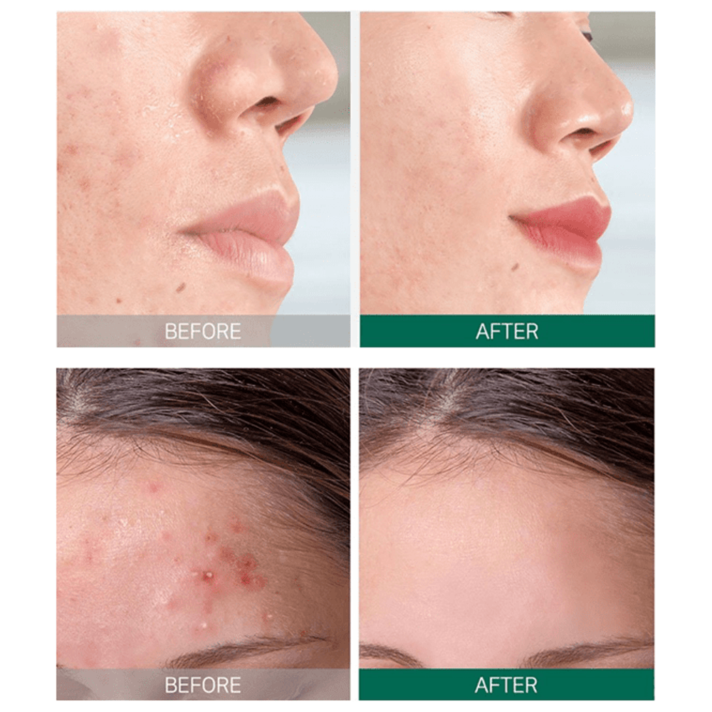 Some By Mi AHA. BHA. PHA 30 Days Miracle Starter - 4 Piece view 3