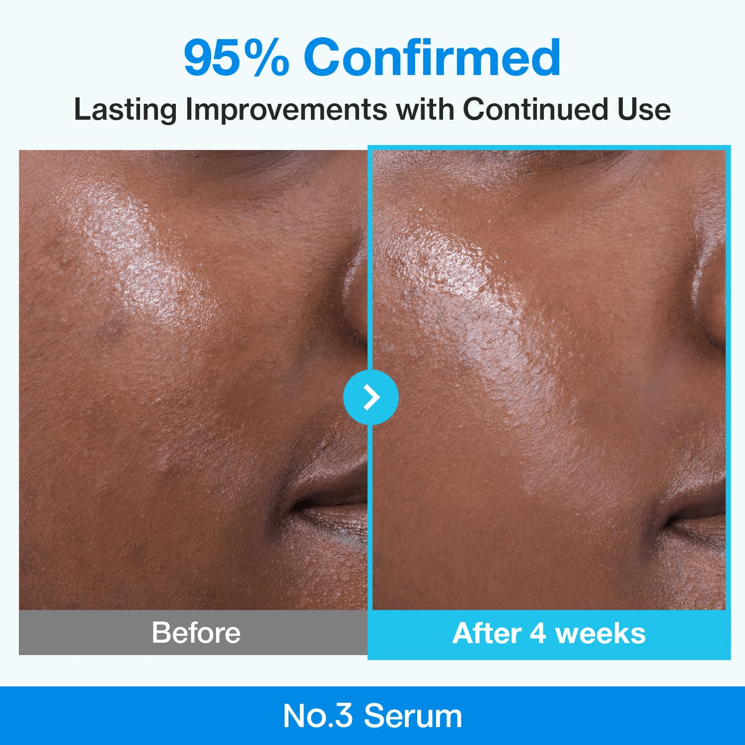 Numbuzin No.3 Blue Bio-Retinol Pore Refining Serum - 30ML view 4