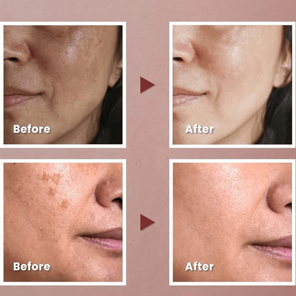 K-Secret Collagen Vita Secret Multi Balm -11g alternate view