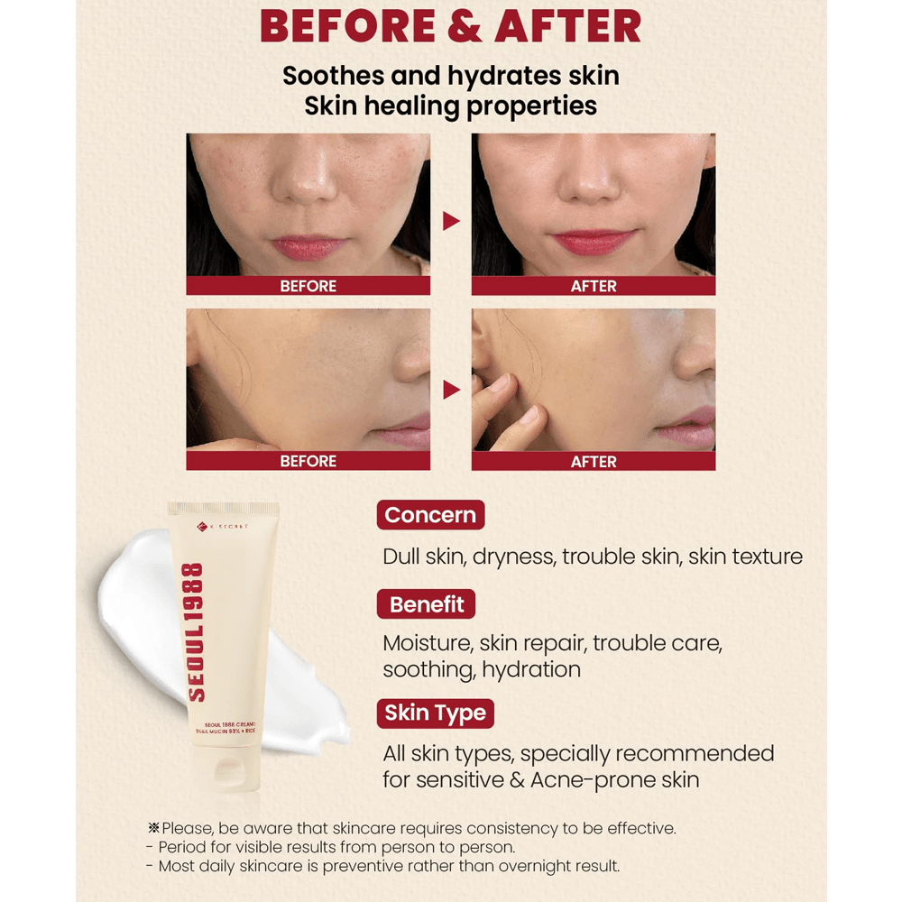 K Secret Seoul 1988 Cream Snail Mucin 93% + Rice - 100 ml view 4