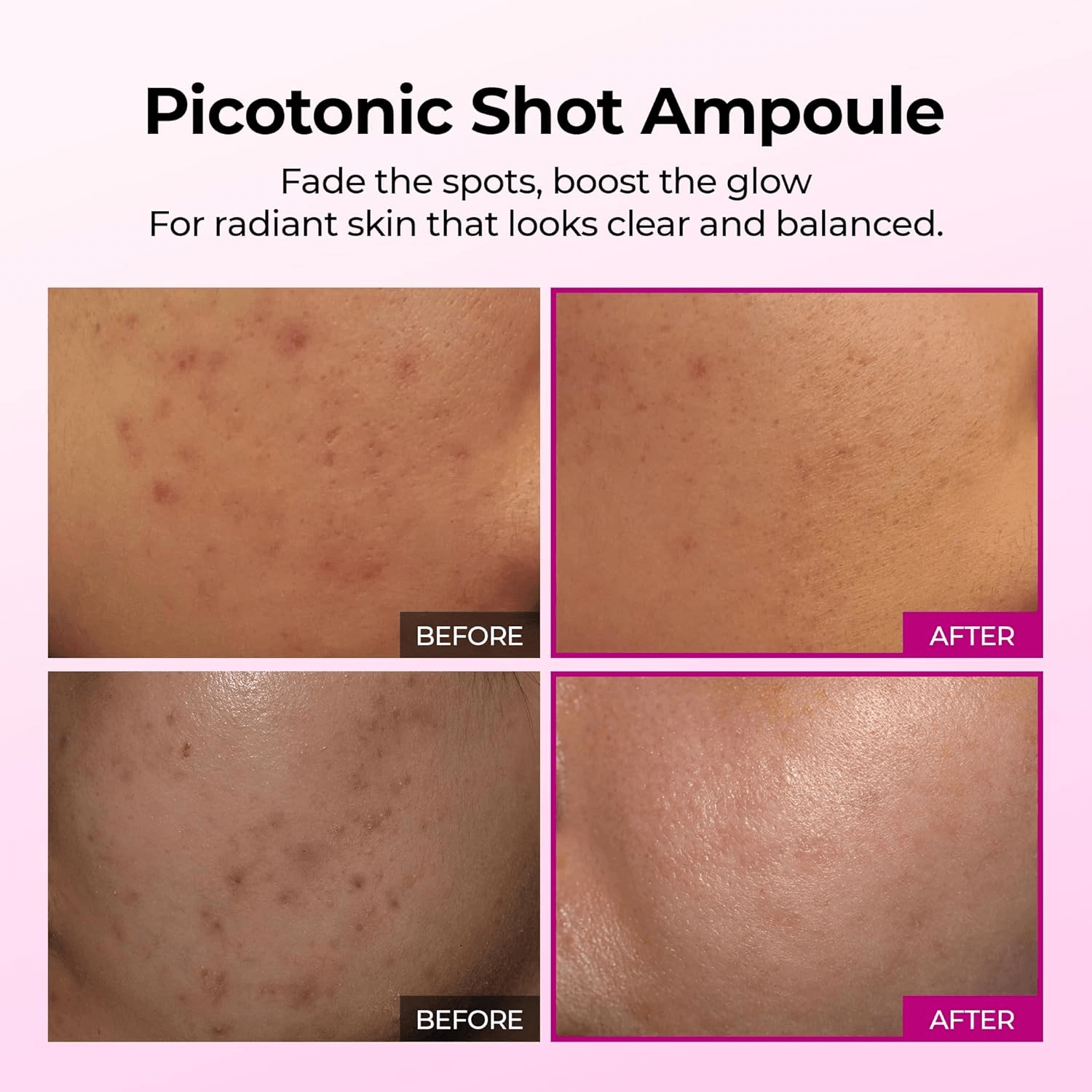 Dr.Melaxin Cemenrete Picotonic Shot Ampoule - 30ml view 3
