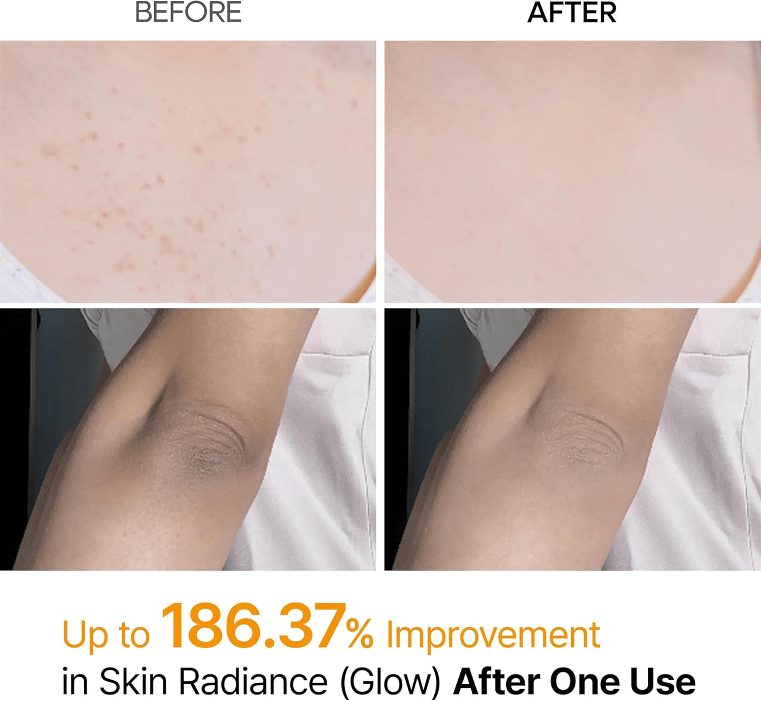 Dr.Melaxin Peel Shot Exfoliating Kojic Acid Turmeric Spray - 200ml view 3